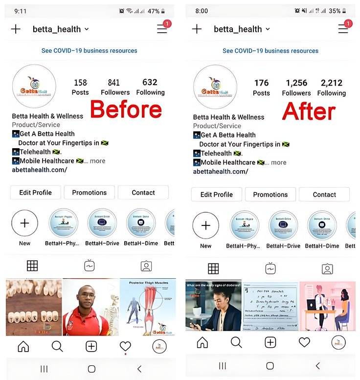 Before: Betta Health Instagram profile with 158 posts, 841 followers, 632 following